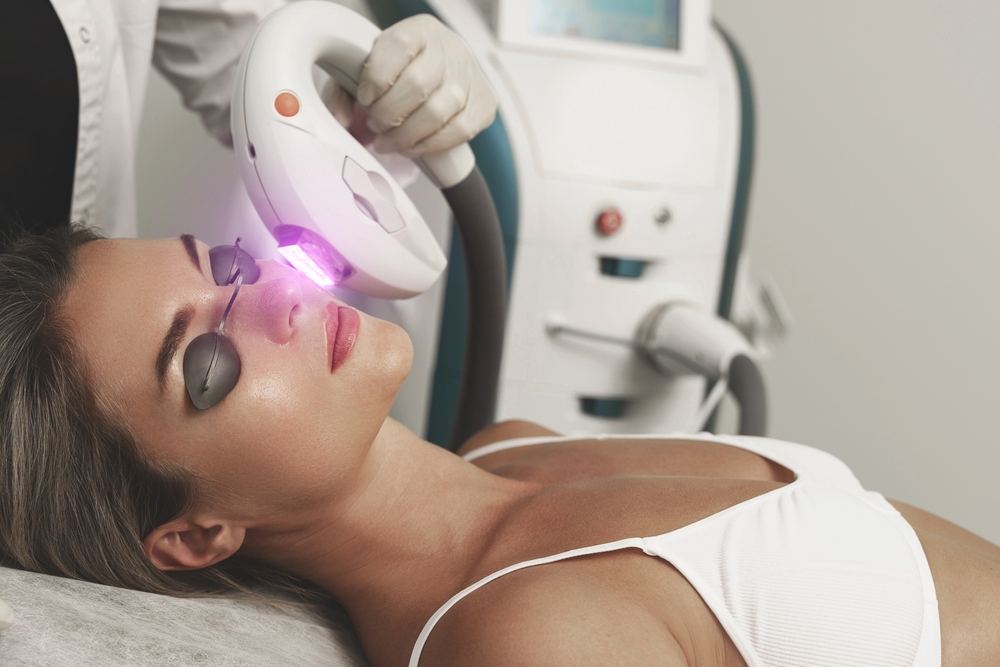 5 Reasons to Try IPL Dark Spot Reduction Treatment in DC Today