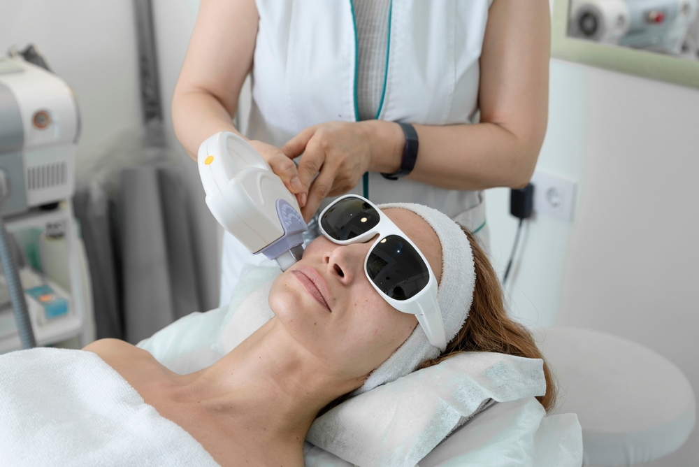 IPL photofacial Washington DC