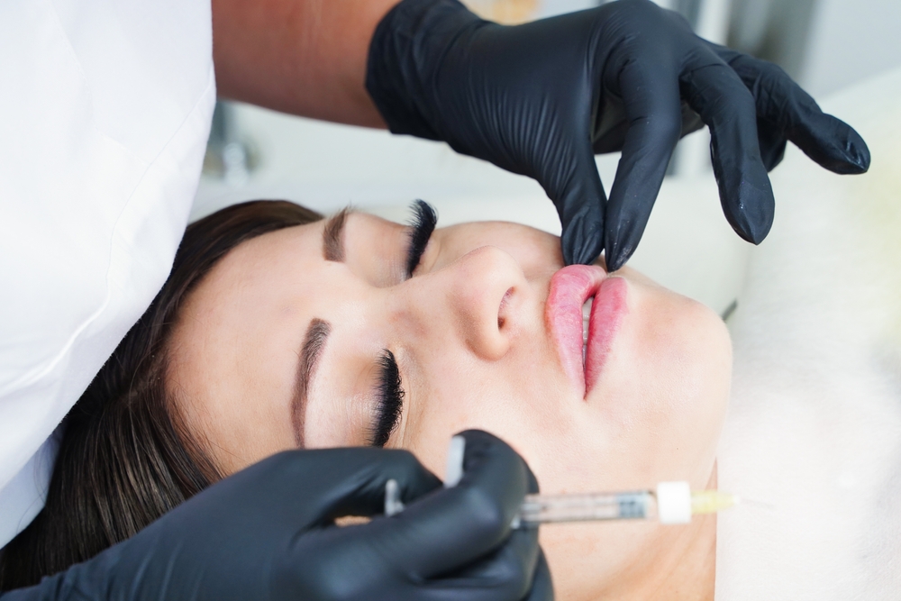 lip filler appointment in Capitol Hill