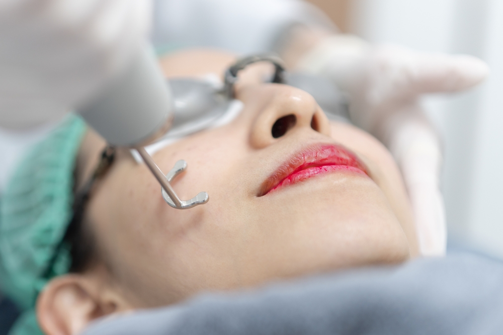 woman getting a brighter complexion with a pico laser in DC