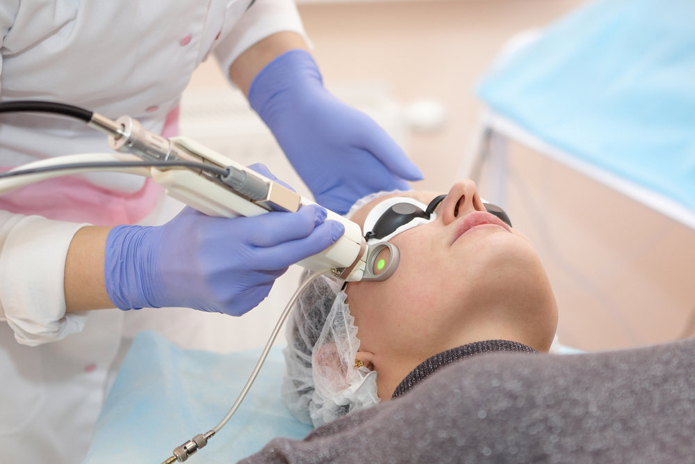 woman trying laser resurfacing to get rid of acne scars
